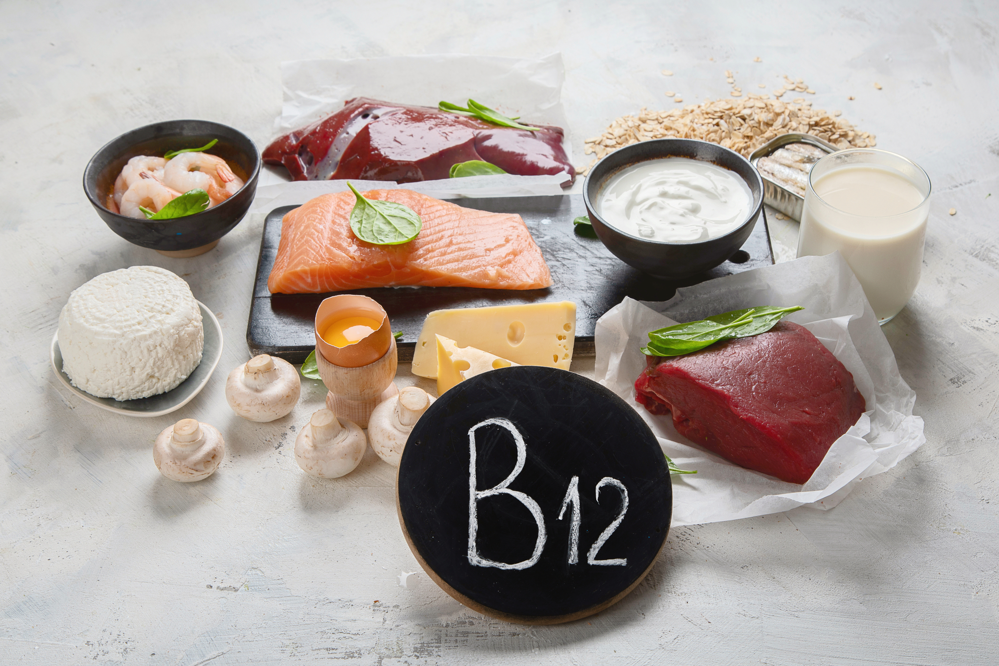 B12 Deficiency